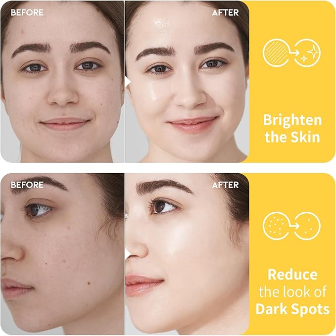 #OOTD Vitamin C Toner for Face – Formula with Niacinamide, Heartleaf, and Squalane – 8.45 FI Oz