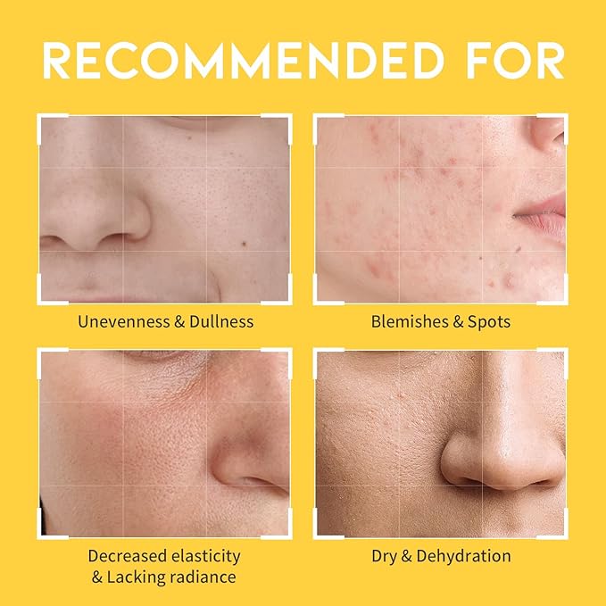 #OOTD Vitamin C Toner for Face – Formula with Niacinamide, Heartleaf, and Squalane – 8.45 FI Oz